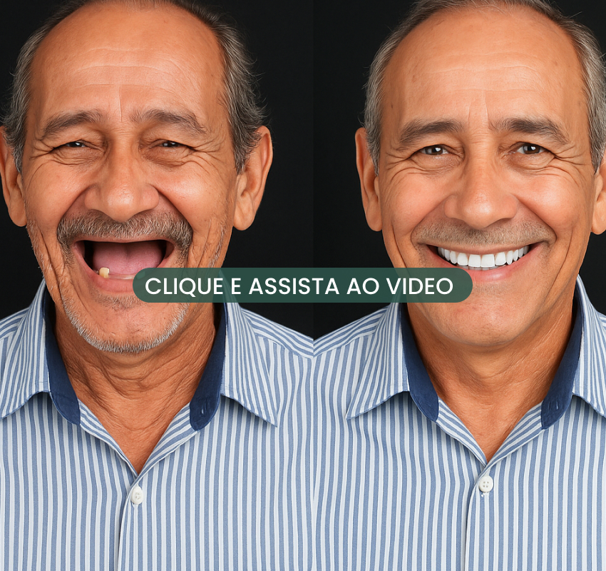Prótese protocolo dentária em arcada completa, fotografia odontológica profissional, paleta azul e branco, close-up em consultório moderno